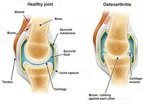 Understanding Elbow and Hip Dysplasia in Dogs: A Guide for Pet Owners